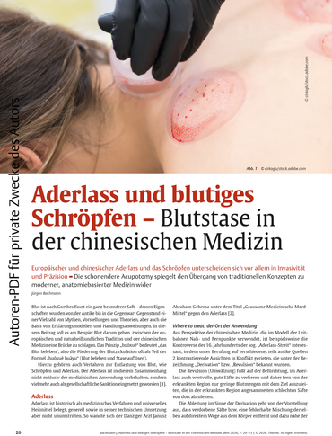 Magazinseite zu Aderlass und blutigem Schröpfen mit Schröpfglas auf nackter Haut