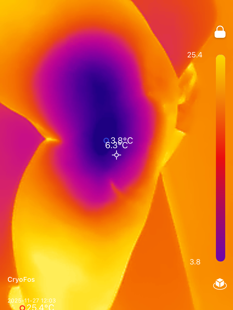 Wärmebild einer Person, das ein violettes Gesicht vor einem orange-gelben Hintergrund mit Temperaturskala zeigt.