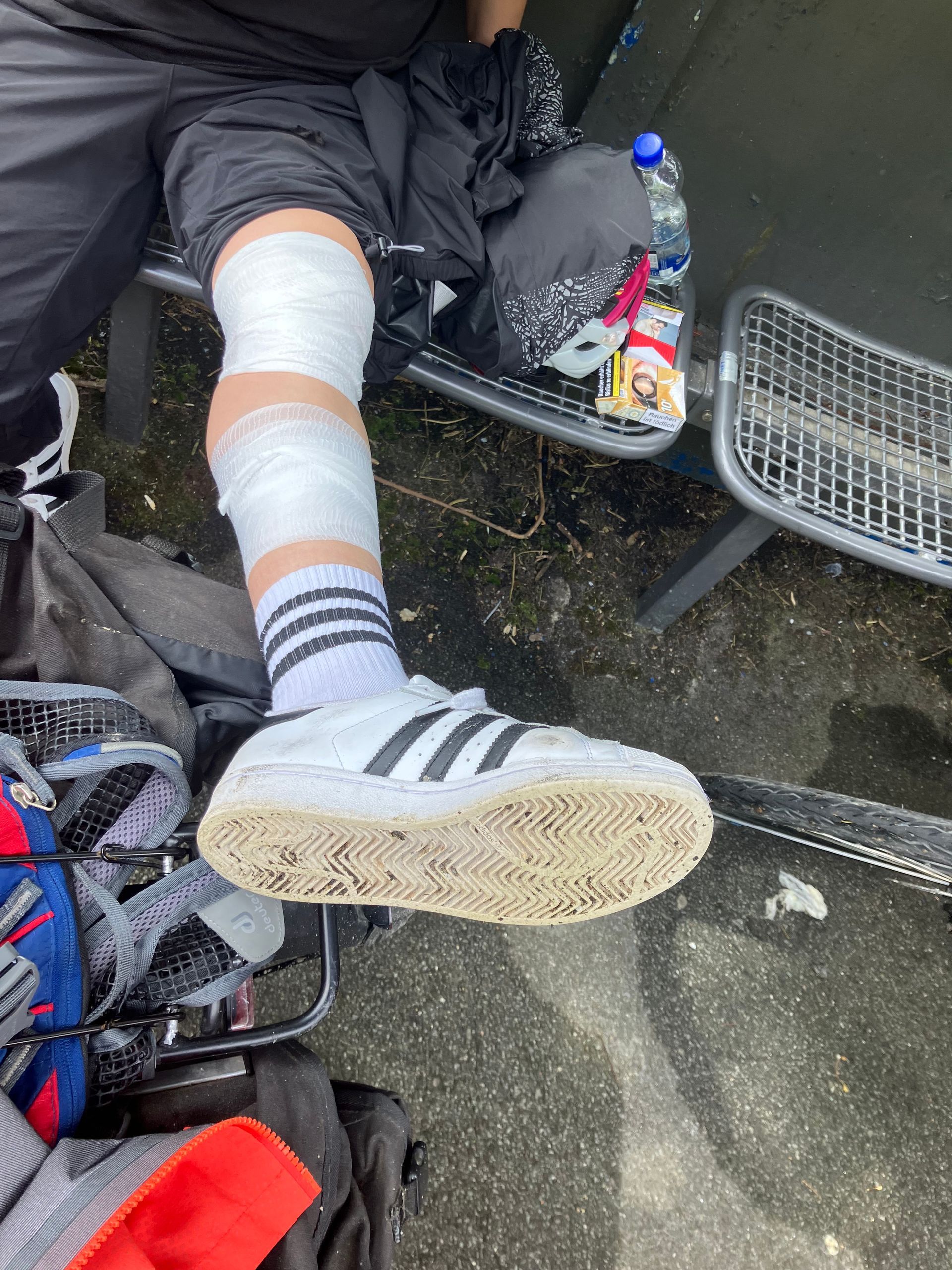 Das Bein, bandagiert in gestreiften Socken und einem weißen Adidas-Schuh, ruht im Freien neben einer Metallbank.