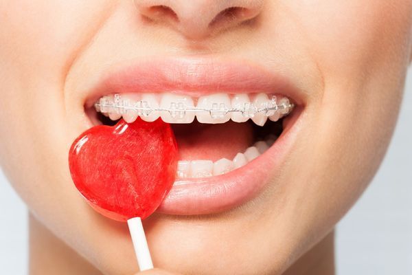 Una mujer con aparatos dentales sostiene una piruleta con forma de corazón en la boca.