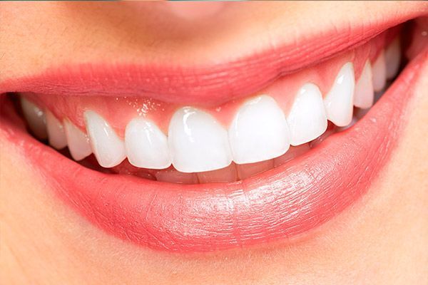 Un primer plano de la sonrisa de una mujer con dientes blancos y labios rojos.