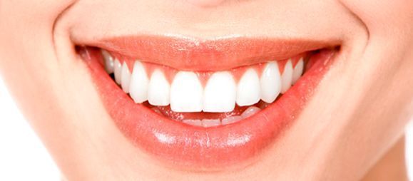 Un primer plano de la sonrisa de una mujer con dientes blancos.