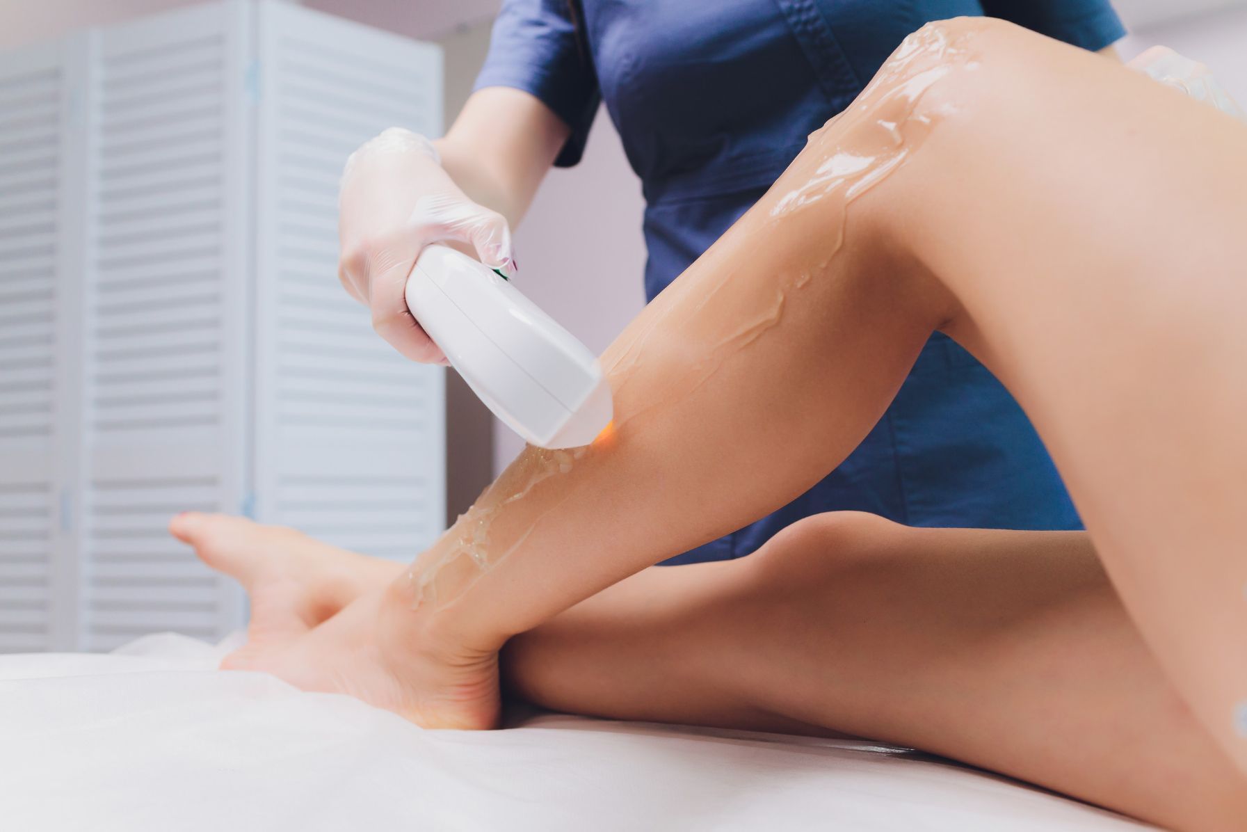 Fotodepilación IPL en Madrid