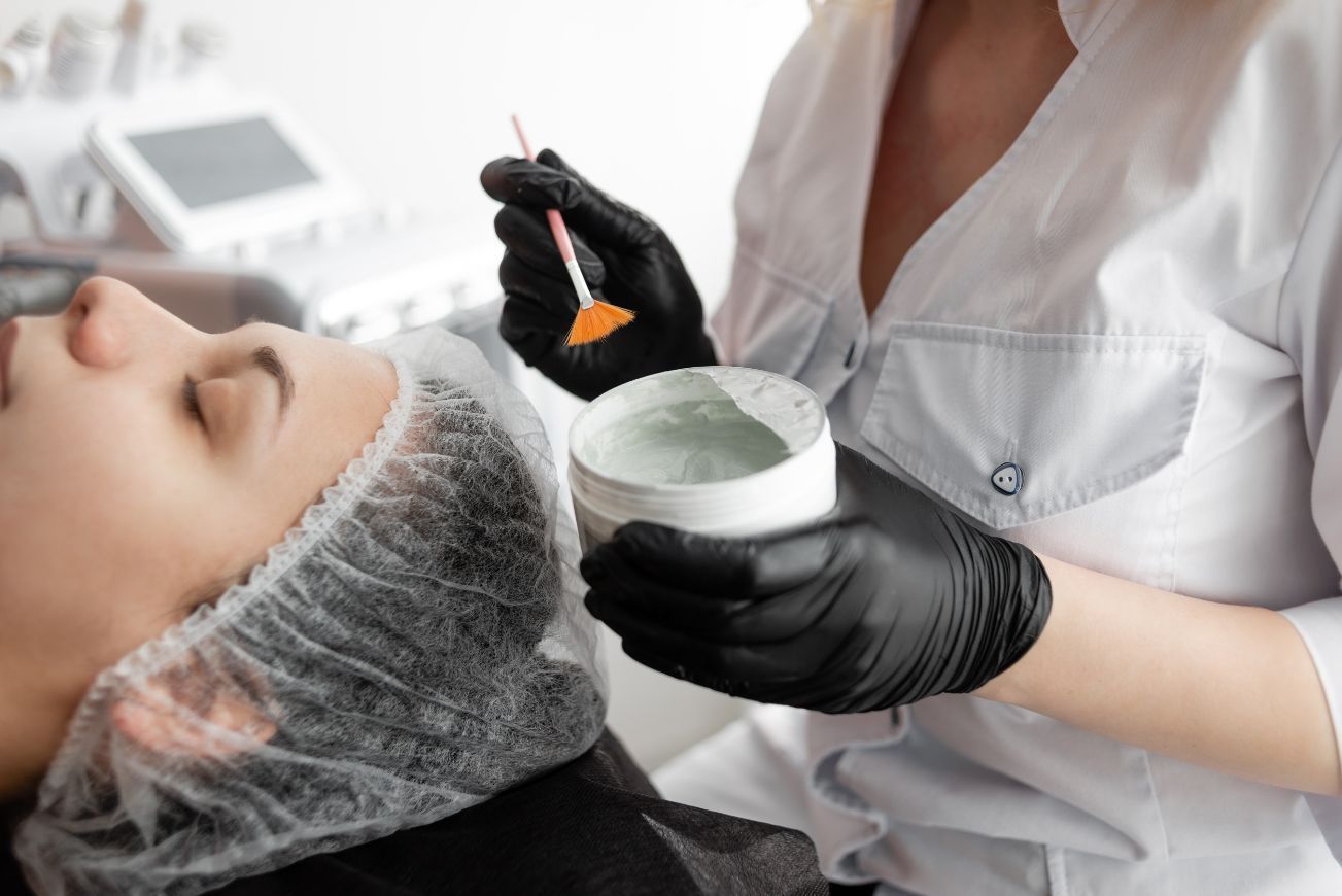 Peeling químico en Madrid