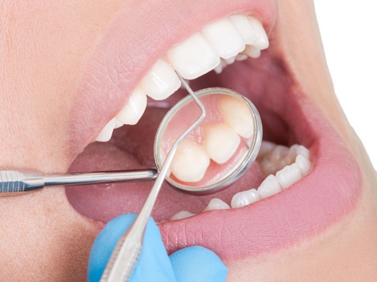 Una mujer está siendo examinada por un dentista.