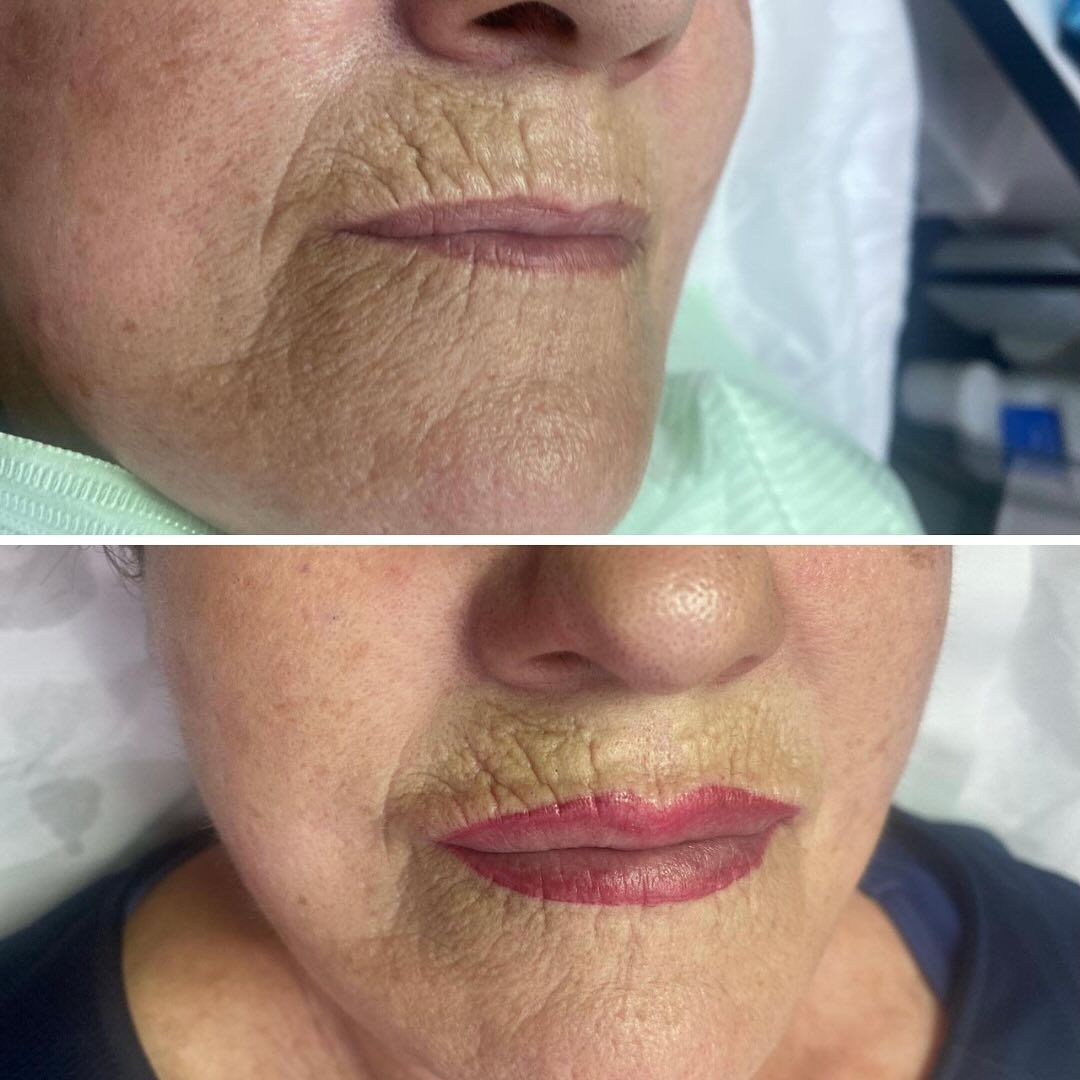 Antes y después de los labios de una persona. Arriba: labios secos y pálidos. Abajo: labios con un tinte rojo oscuro.