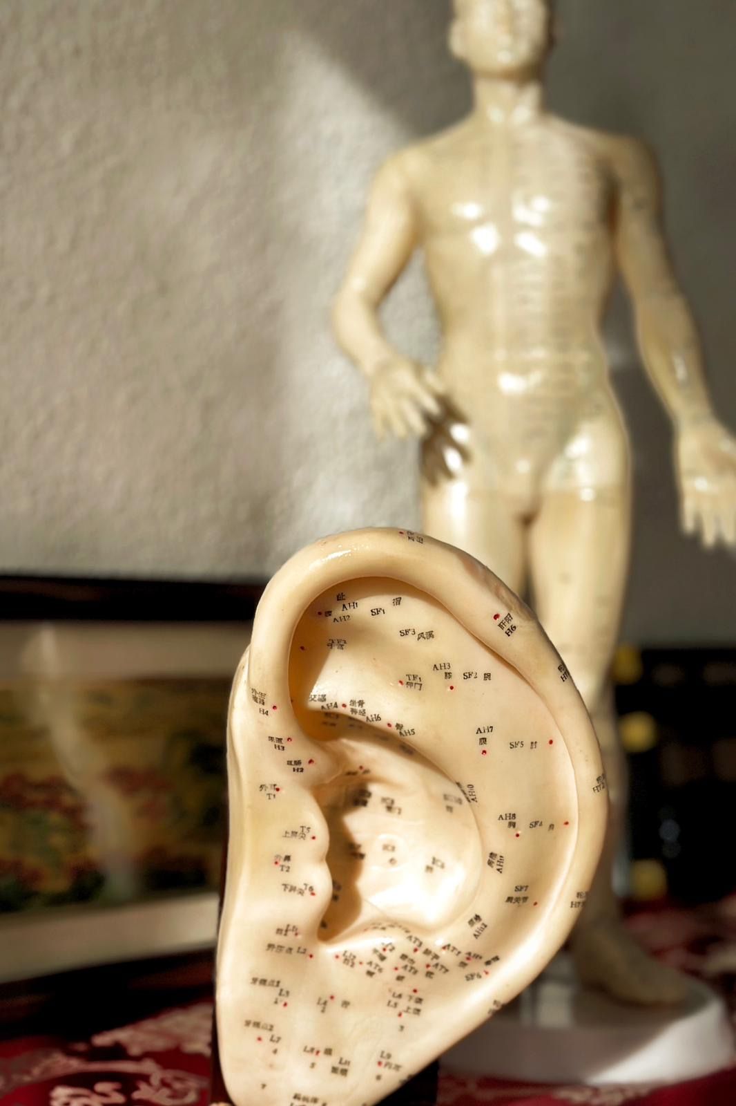 Une femme reçoit de l'acupuncture dans l'oreille.