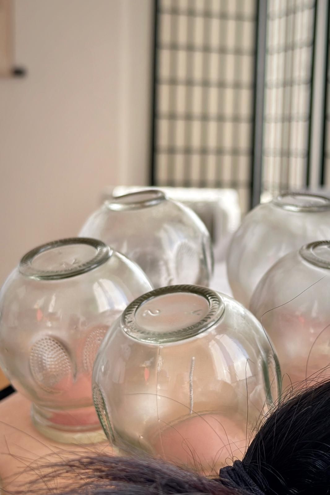 Une personne reçoit un traitement de ventouses sur le dos.