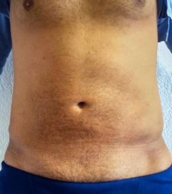 Torso einer Person mit sichtbarer Körperbehaarung und etwas dunklerem Hautton.