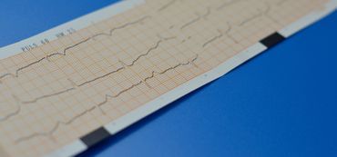 EKG Messung