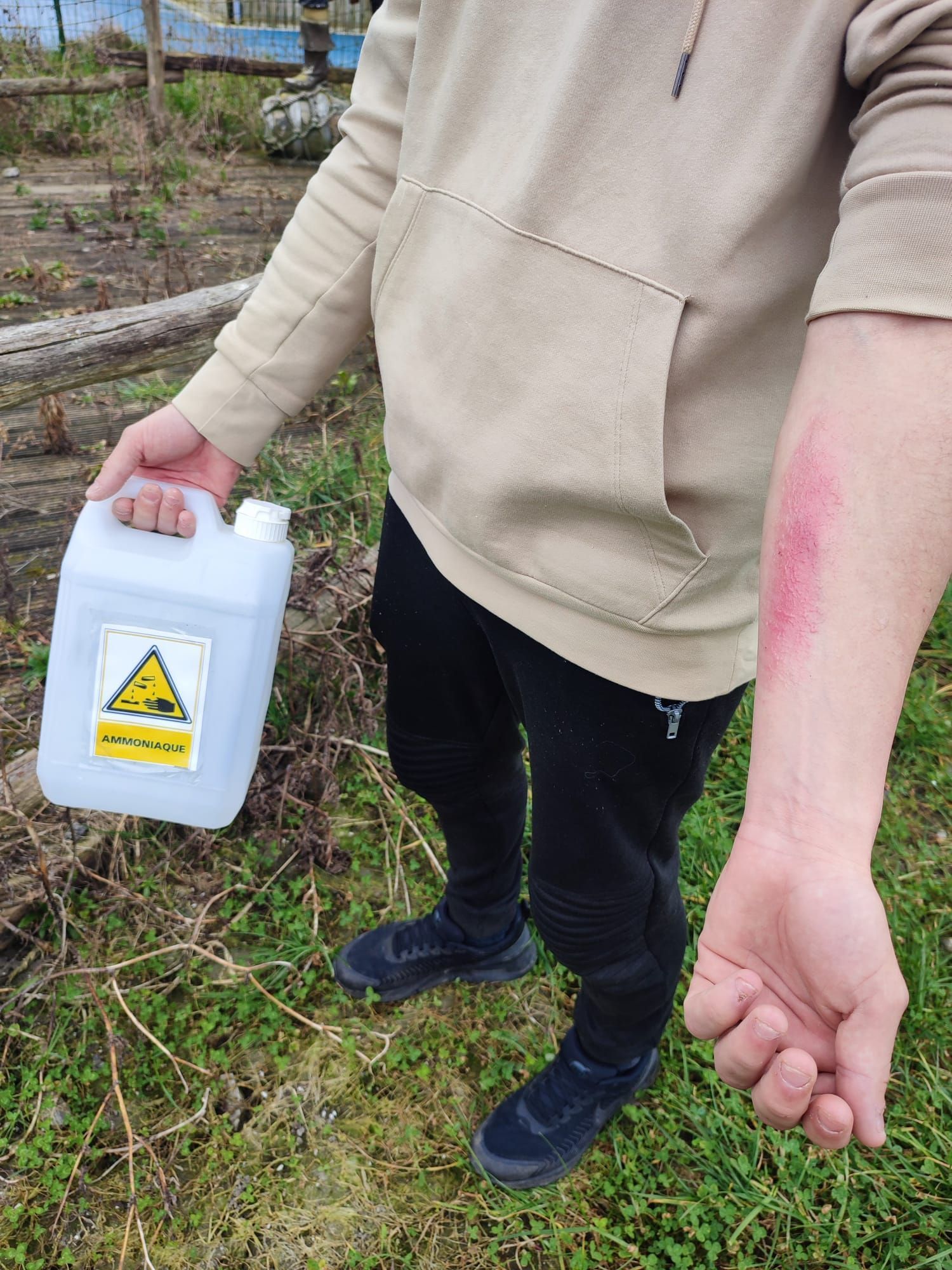 Un homme avec un bidon dans la main et une brûlure sur le bras.