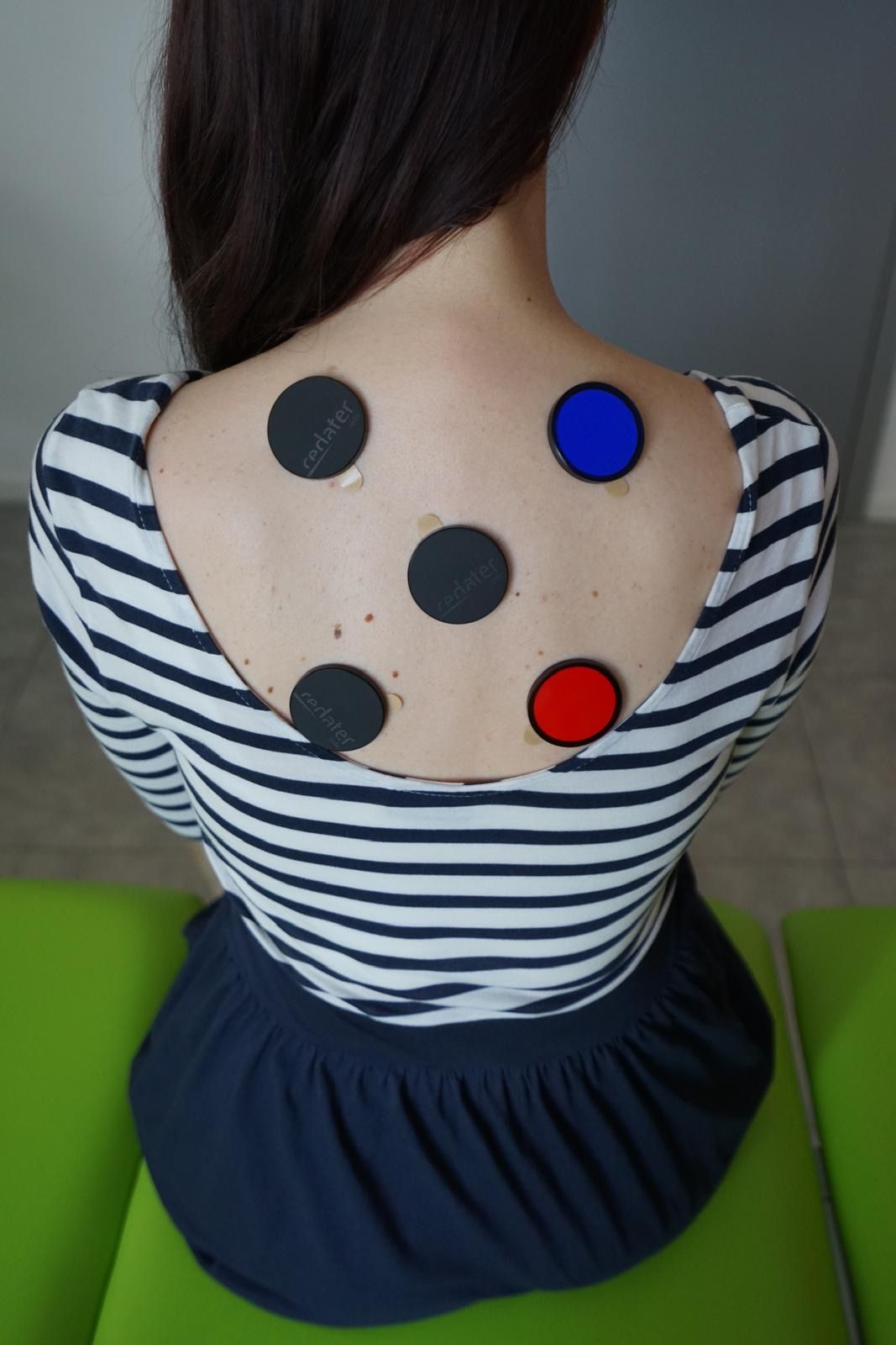 Eine Frau in einem gestreiften Hemd hat Kreise auf ihrem Rücken.