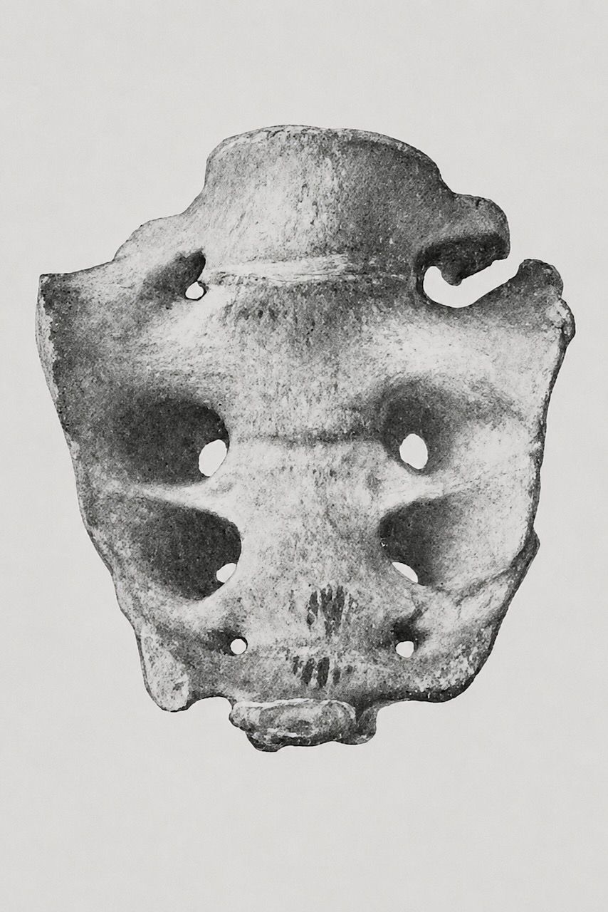 Black-and-white image of a pelvis bone with holes and a central notch, shown frontally on a plain background