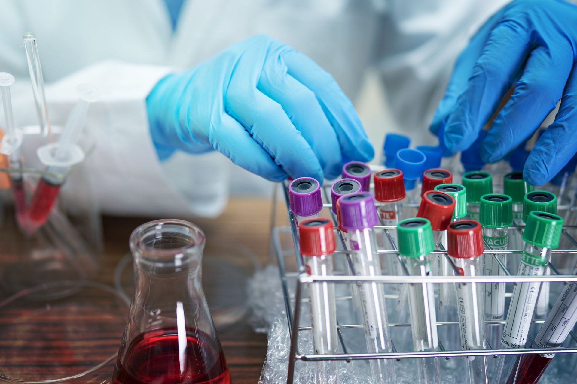 Un técnico de laboratorio que usa guantes azules y bata trabaja con tubos de ensayo llenos de muestras de sangre.