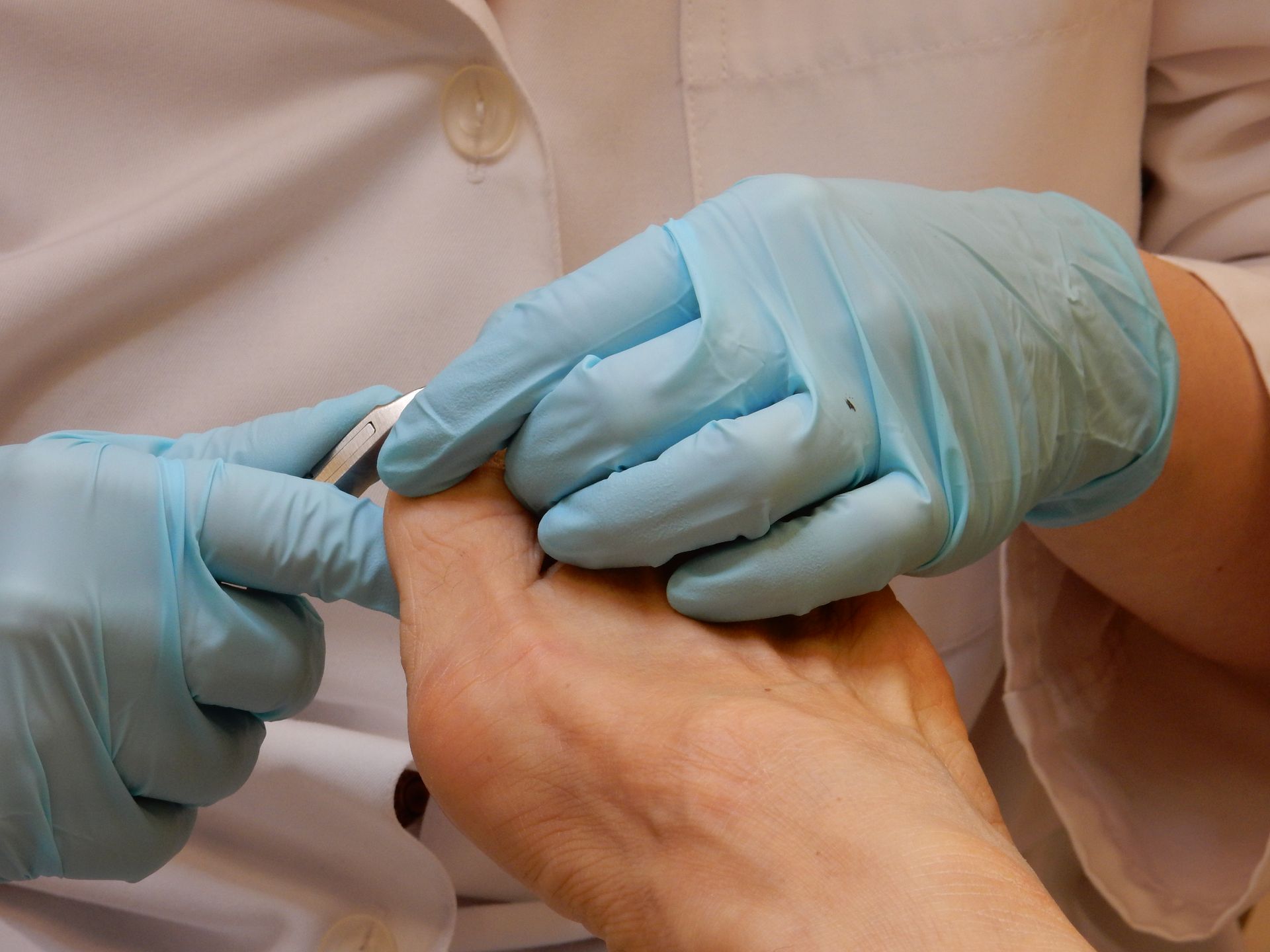 Un primo piano del piede di una persona esaminato da un medico.