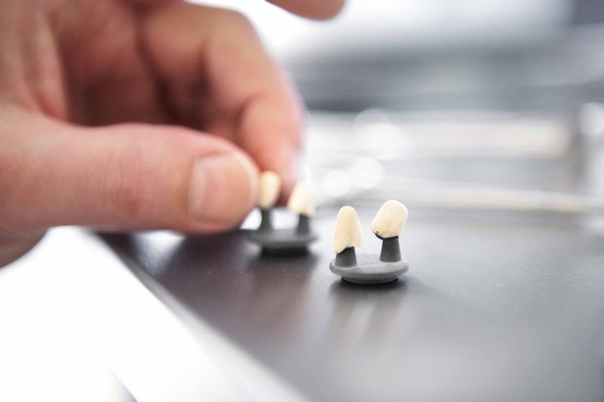 Kronen - HM TECH GmbH