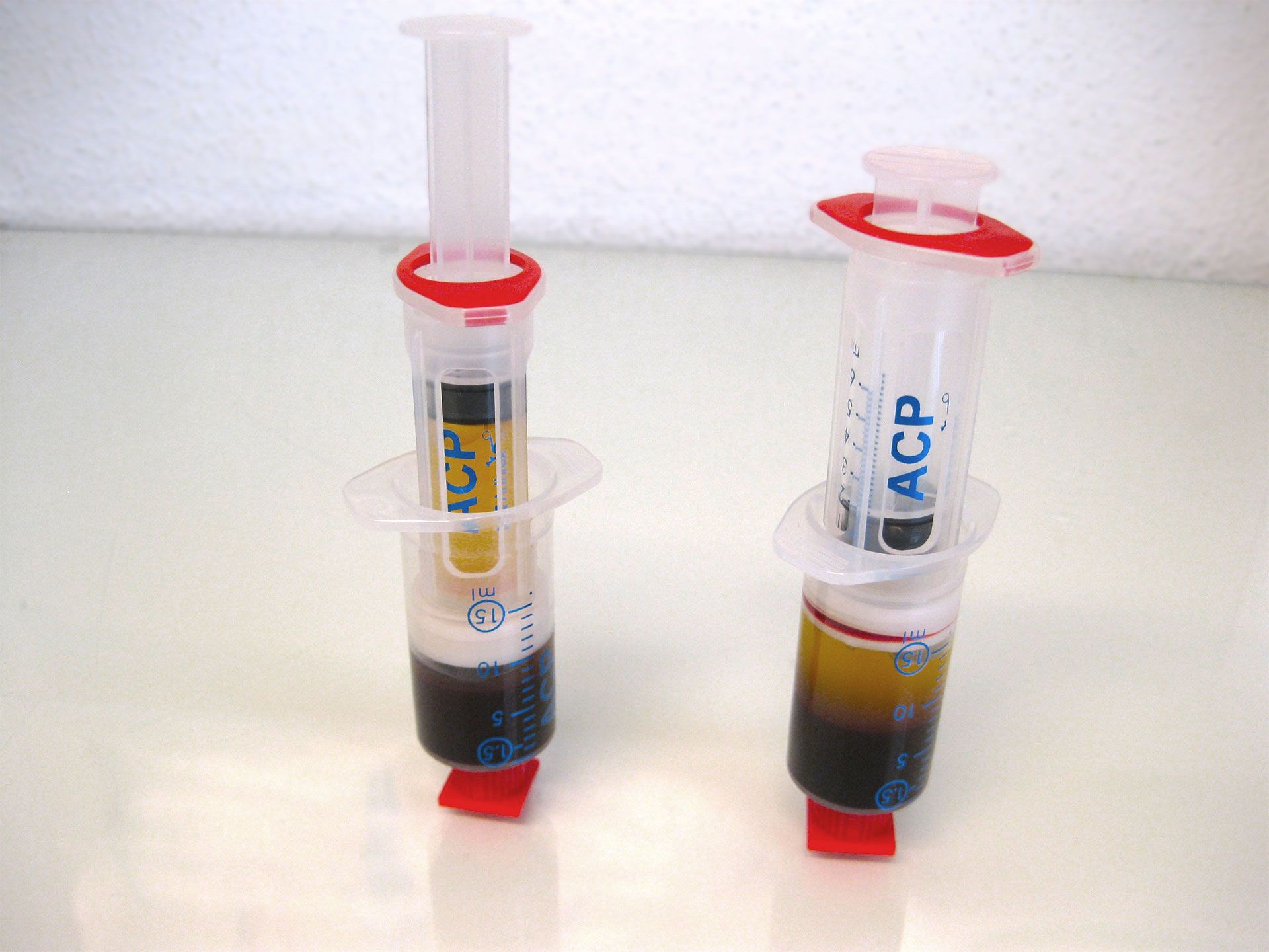 ACP-Spritzen vor und nach der Trennung der Phasen