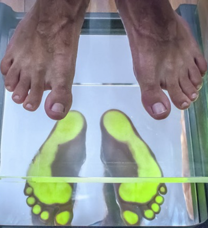 Photo de création de semelle orthopédiques