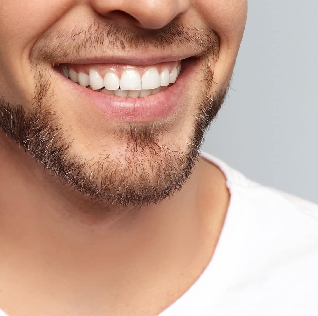 Un hombre con barba y dientes blancos está sonriendo.