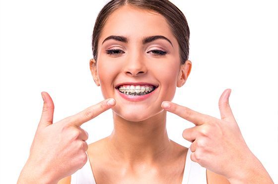 Una mujer con aparatos dentales sonríe y señala sus dientes.
