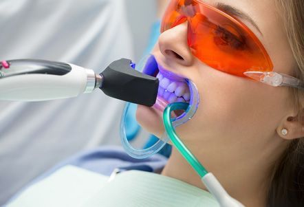 Una mujer se está blanqueando los dientes con un dentista.