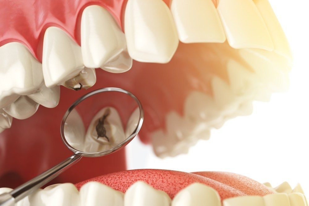 Un dentista está examinando los dientes de una persona con un espejo.