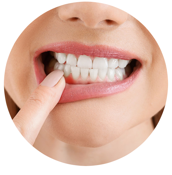 Un primer plano de los dientes de una mujer con un dedo en la boca.