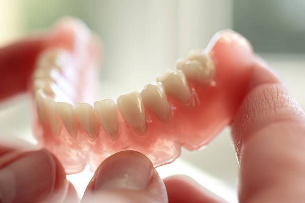 Una persona sostiene una dentadura postiza en sus manos.