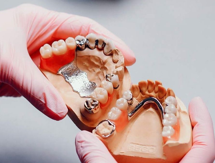 Una persona sostiene en sus manos un modelo de un puente dental.