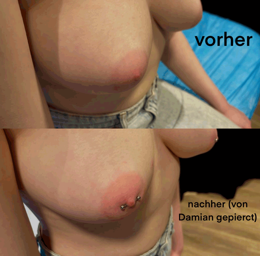 Brustwarzenpiercings. Vorher/nachher Vergleich