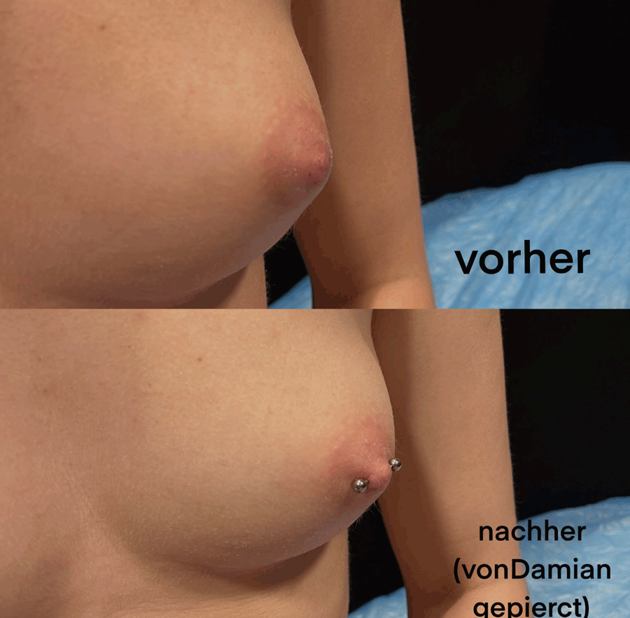 Brustwarzenpiercings. Vorher/nachher Vergleich