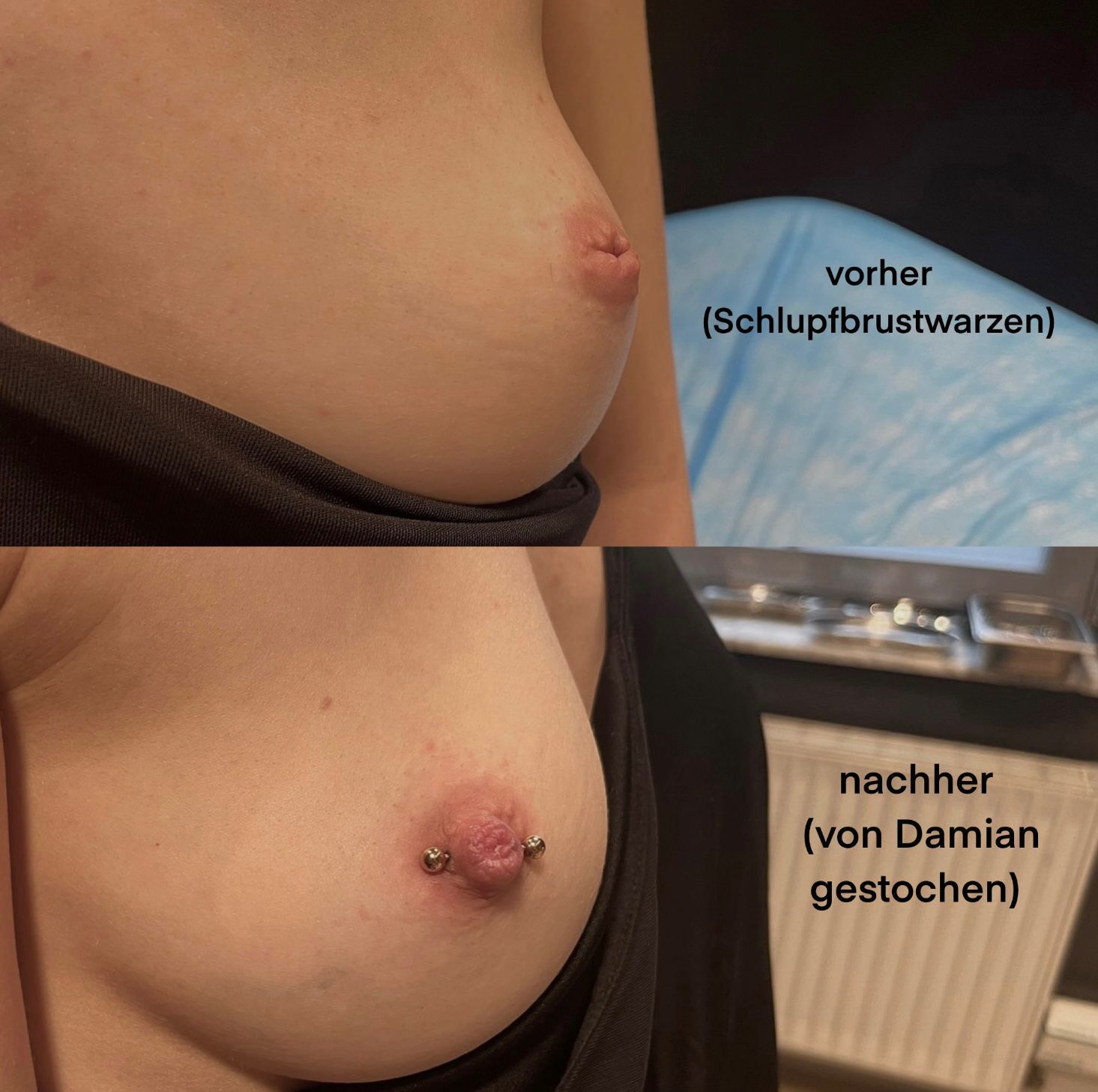 Brustwarzenpiercings. Vorher/nachher Vergleich
