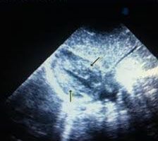 Καρδιολόγος Κώτσας Δημήτρης