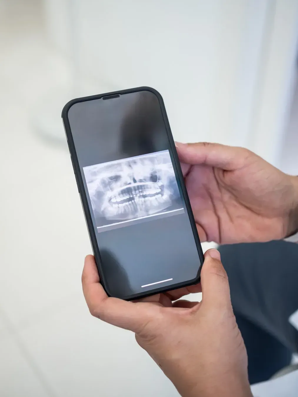 Persona que sostiene un teléfono inteligente que muestra una radiografía dental.