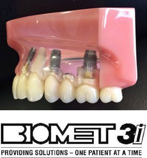 Un modelo de boca con implantes dentales y el logotipo de Biomet 31.