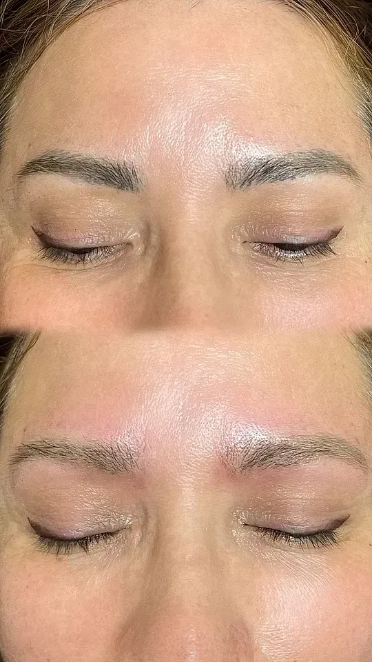 Una fotografía de antes y después de las cejas de una mujer.