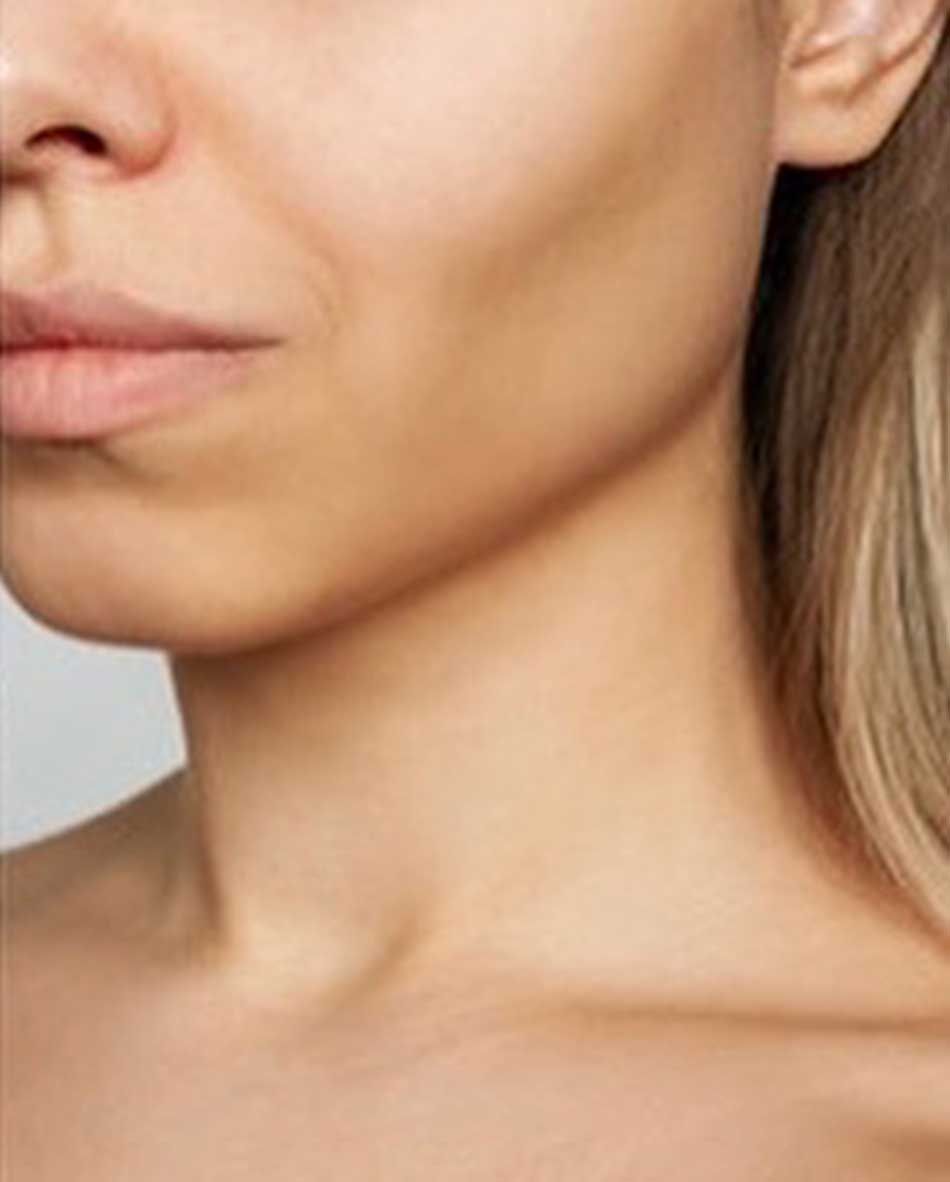 Jawline Hyaluron