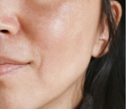 Haut ohne Pigmentflecken