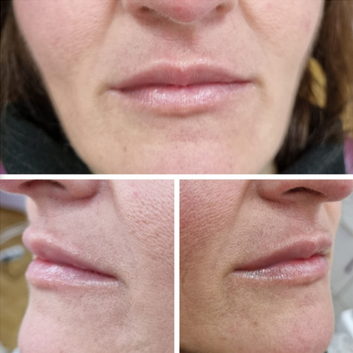Collage de primeros planos laterales y frontales de los labios que muestran la textura de los labios y la piel natural.