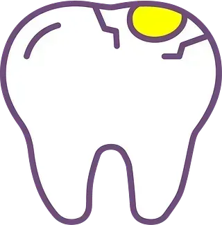 Diente blanco de dibujos animados con contorno morado y empaste amarillo cerca de la parte superior derecha.