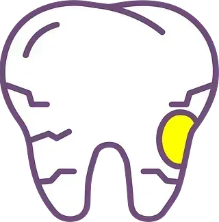 Diagrama dental simple con un área resaltada en amarillo en el lado derecho.