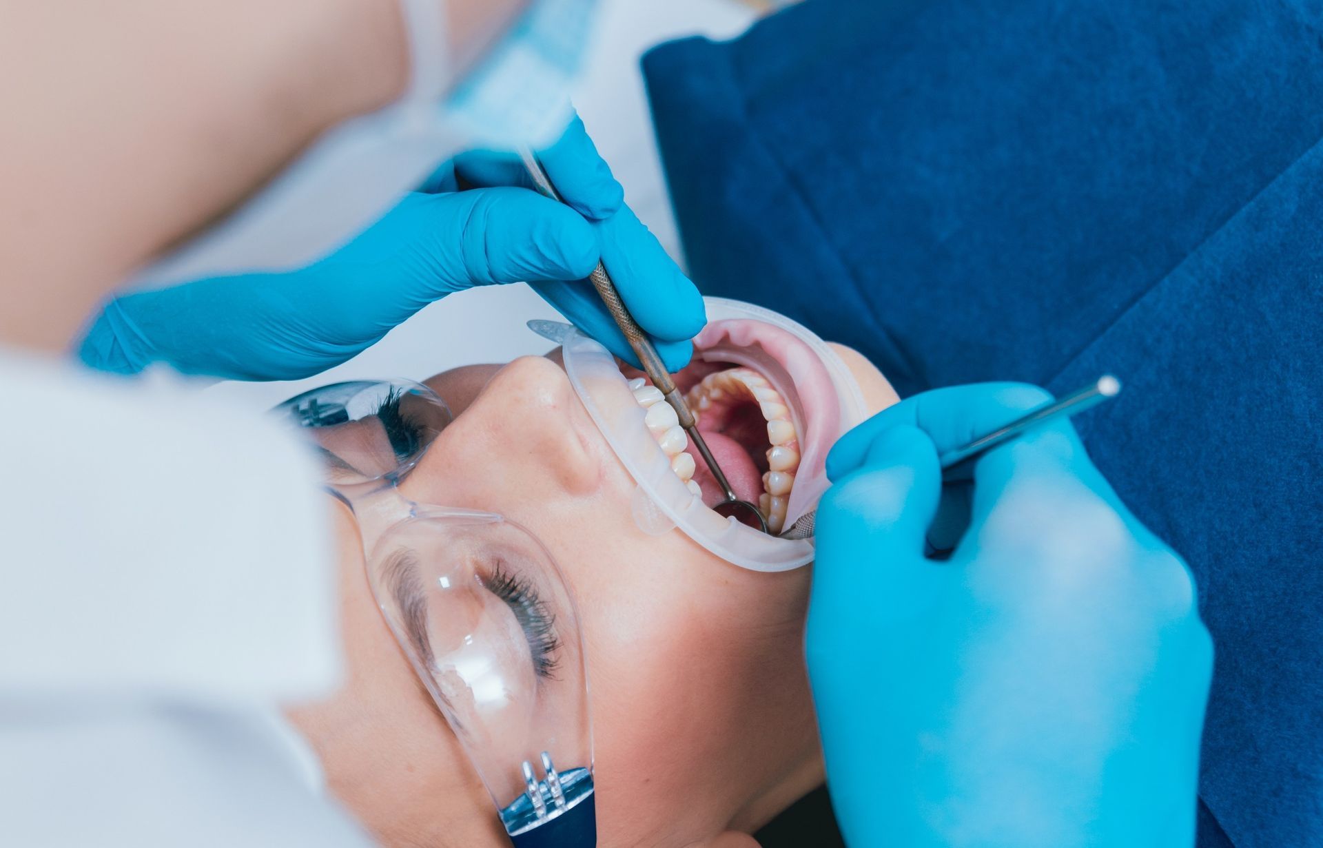 Odontólogo examinando la boca abierta del paciente con instrumentos dentales y guantes azules durante un procedimiento.