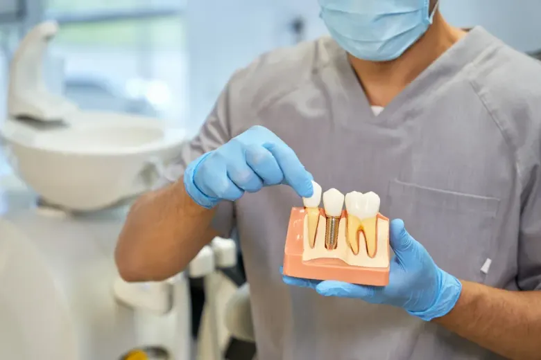 Dentista con guantes azules y mascarilla sostiene un modelo dental con sección transversal de los dientes.