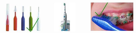Herramientas de higiene dental: cepillos interdentales, cepillo eléctrico, cepillo de limpieza de aparatos dentales.