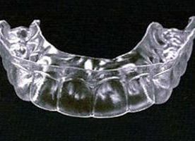 Retenedor dental de plástico transparente, moldeado para adaptarse a los dientes inferiores, que descansa sobre una superficie negra.