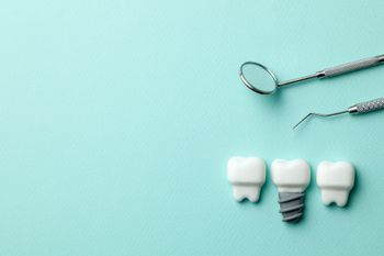 Herramientas dentales y tres modelos de dientes sobre un fondo azul; uno de los modelos tiene un implante de plata.