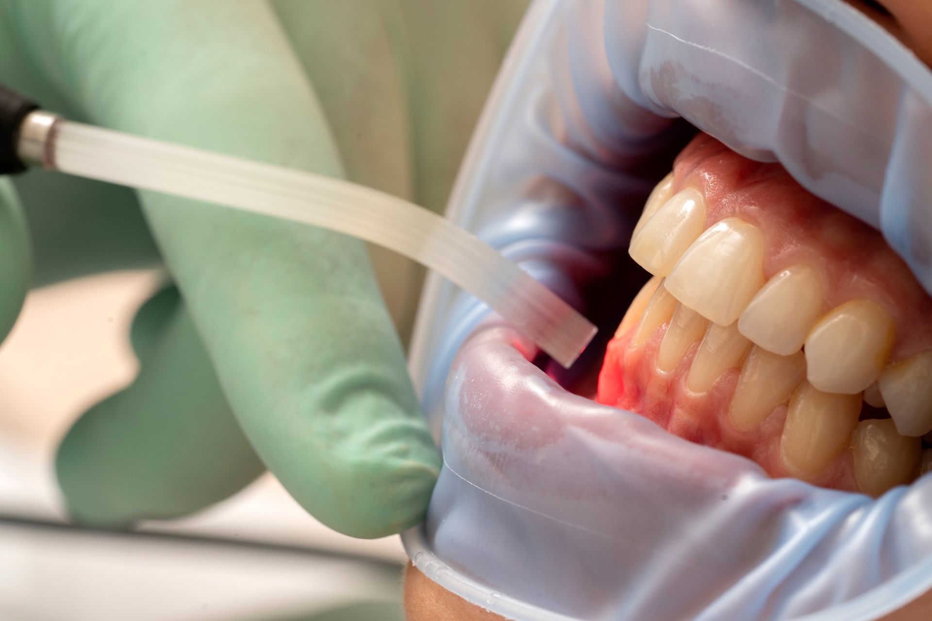 Dentista examinando la boca abierta de un paciente con herramientas en un entorno clínico.