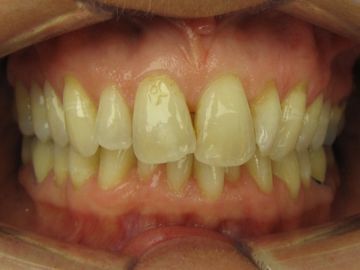Zahnarzt Kieferorthopädie - Dr. med. dent. Corinna Toepel-Sievers Praxis für Kieferorthopädie - Erlenbach ZH