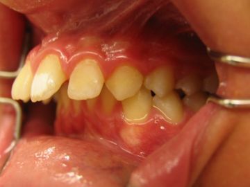 Zahnarzt Kieferorthopädie - Dr. med. dent. Corinna Toepel-Sievers Praxis für Kieferorthopädie - Erlenbach ZH