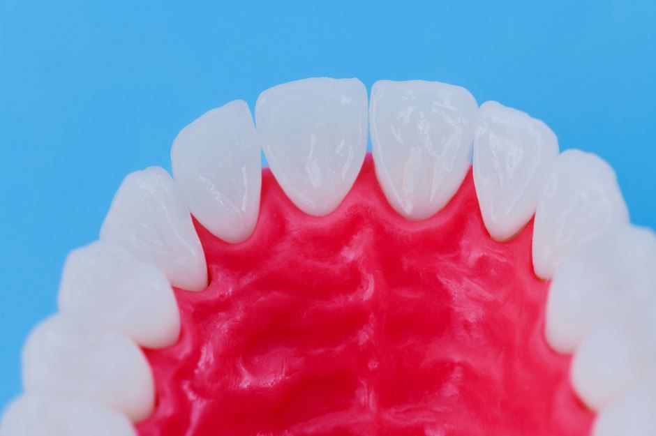 Vista de primer plano de un modelo dental que muestra dientes blancos y encías rojas sobre un fondo azul.